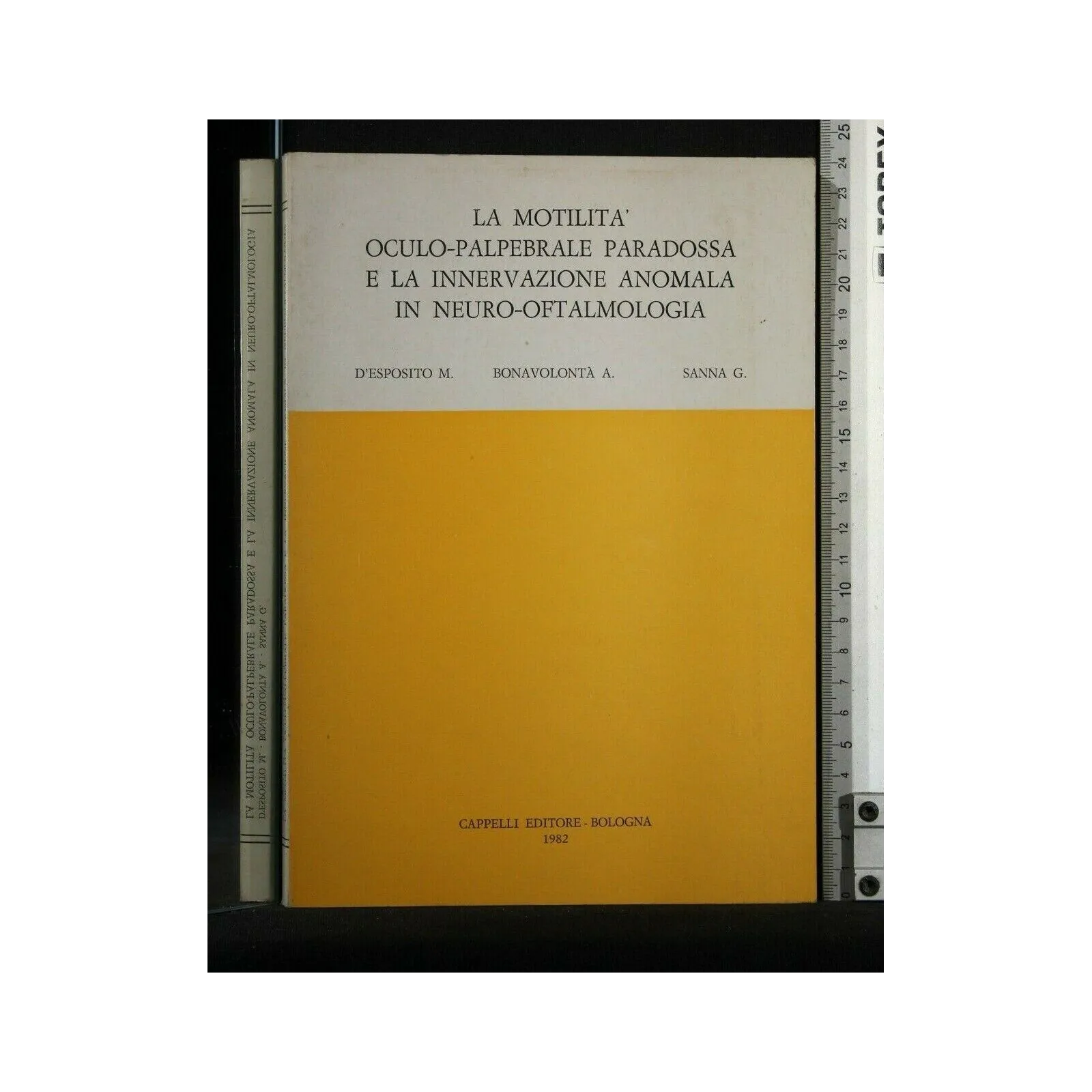 LA MOTILITA' OCULO-PALPEBRALE PARADOSSA E LA INNNERVAZIONE