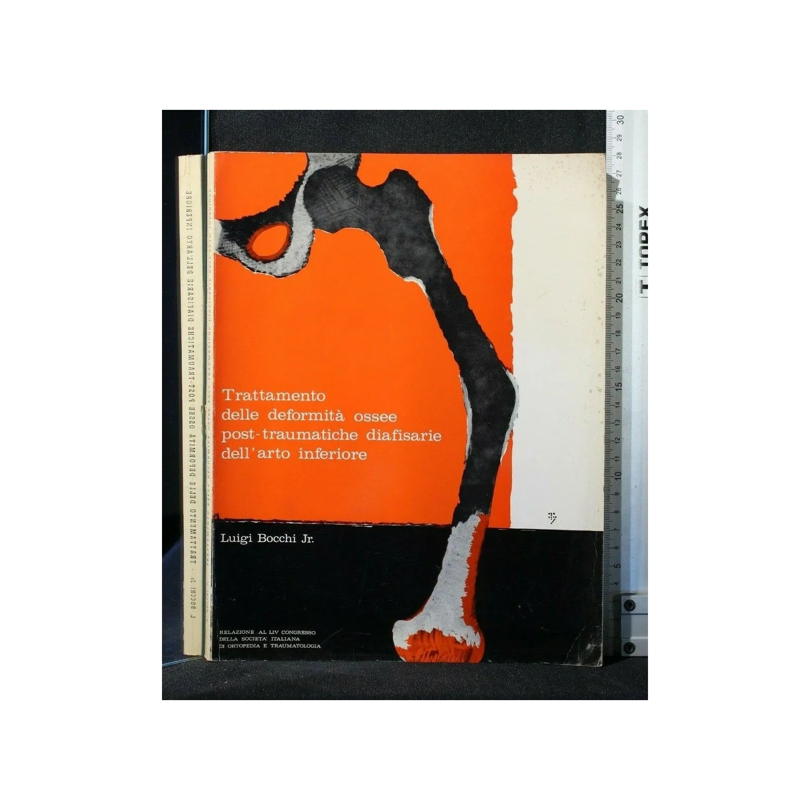 TRATTAMENTO DELLE DEFORMITA' OSSEE POST-TRAUMATICHE DIAFISARIE