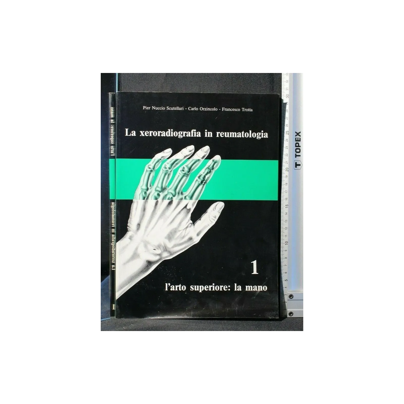 LA XERORADIOGRAFIA IN REUMATOLOGIA L'ARTO SUPERIORE: LA MANO