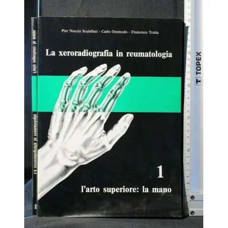 LA XERORADIOGRAFIA IN REUMATOLOGIA L'ARTO SUPERIORE: LA MANO