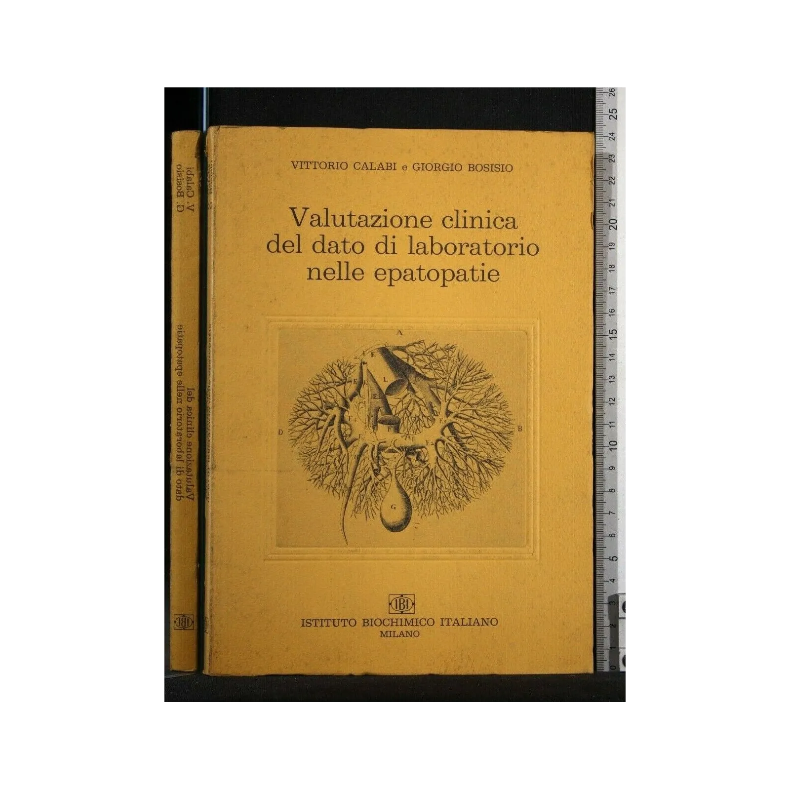 VALUTAZIONE CLINICA DEL DATO DI LABORATORIO NELLE EPATOPATIE