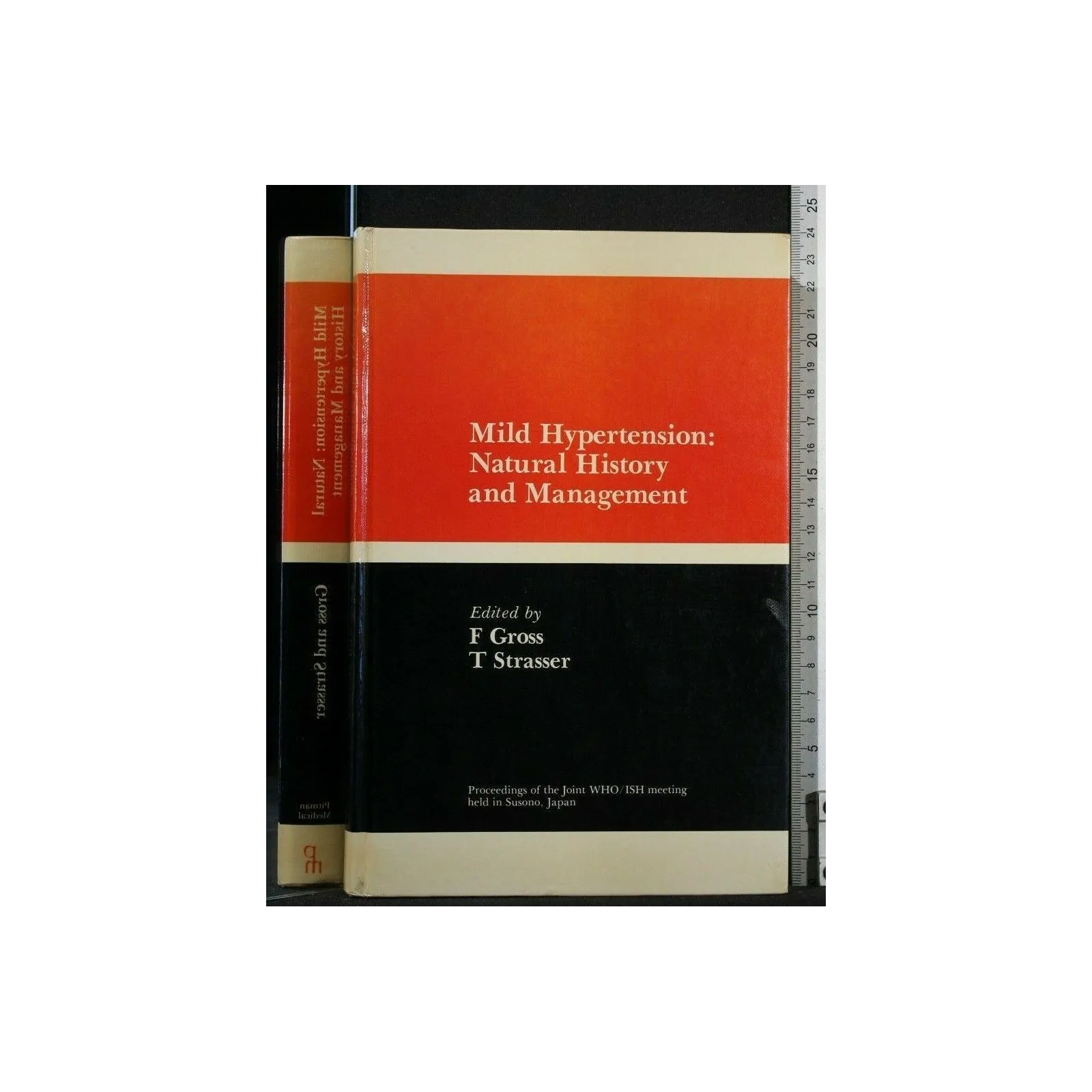 MILD HYPERTENSION: NATURAL HISTORY ANDMANAGEMENT