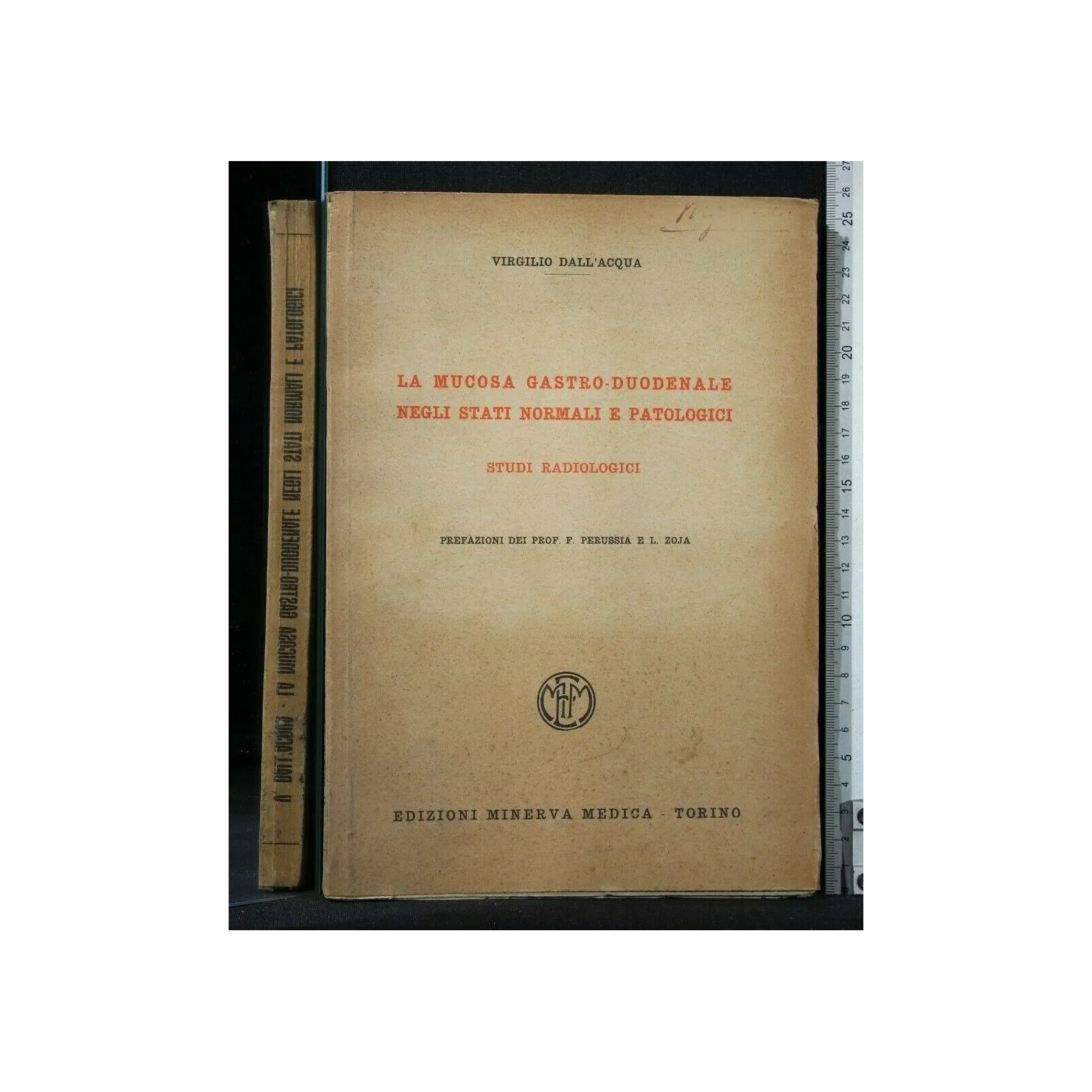 LA MUCOSA GASTRO-DUODENALE NEGLI STATI NORMALI E PATOLOGICI