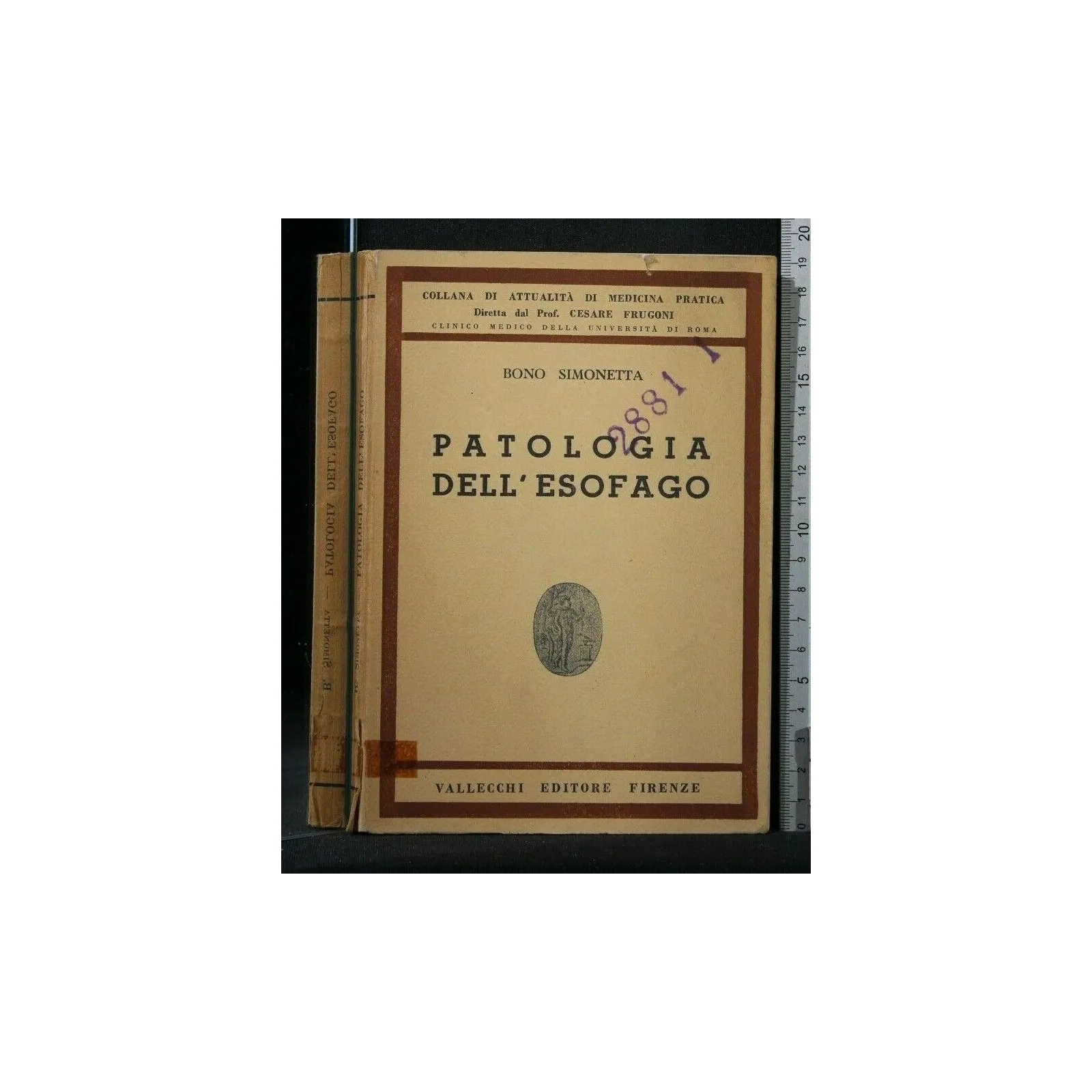 PATOLOGIA DELL'ESOFAGO