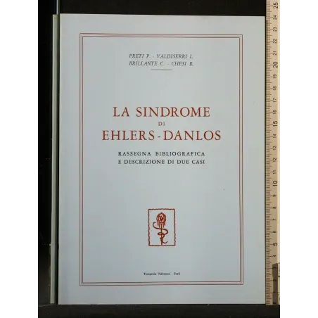 LA SINDROME DI EHLERS-DANLOS