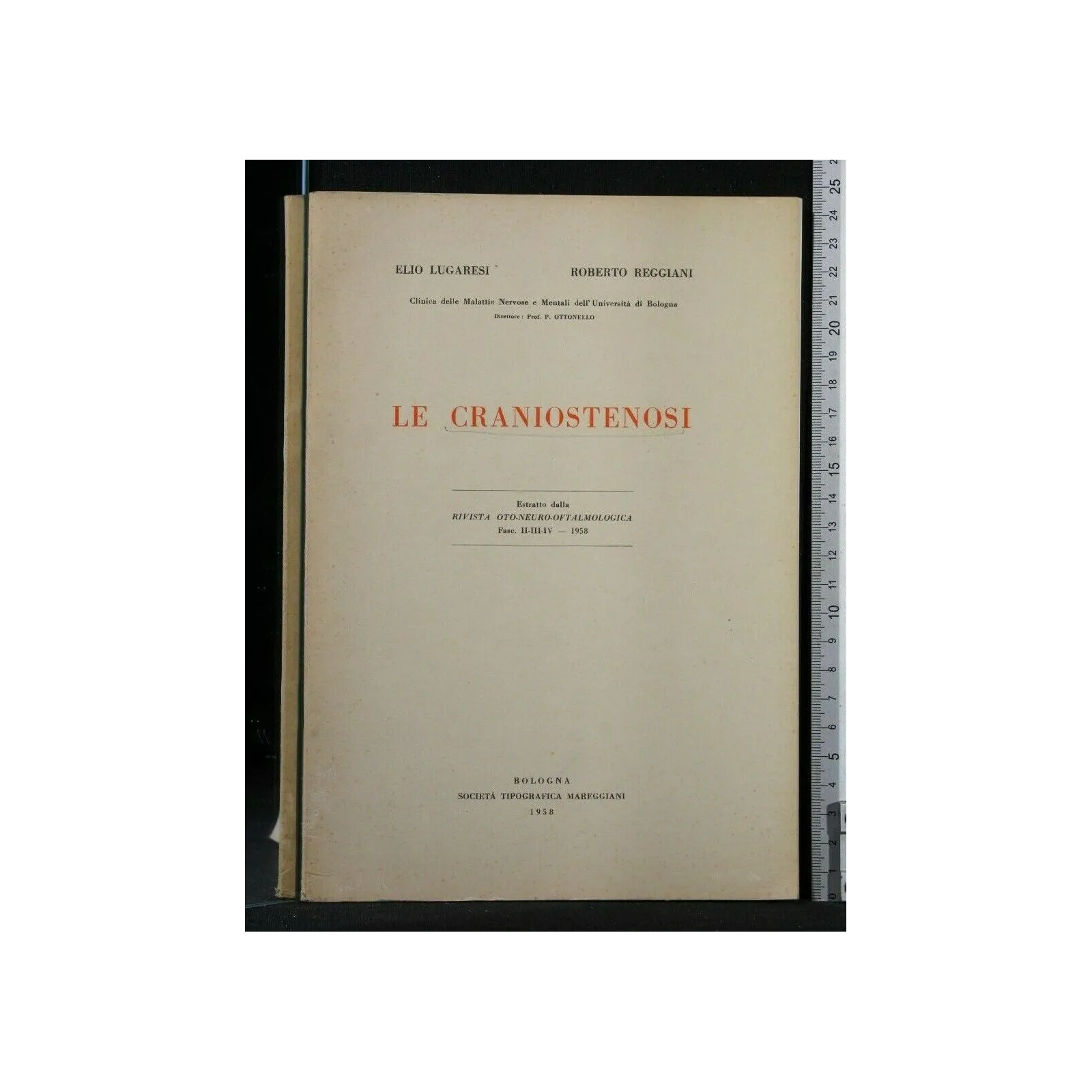 LE CRANIOSTENOSI