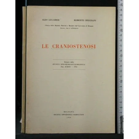 LE CRANIOSTENOSI