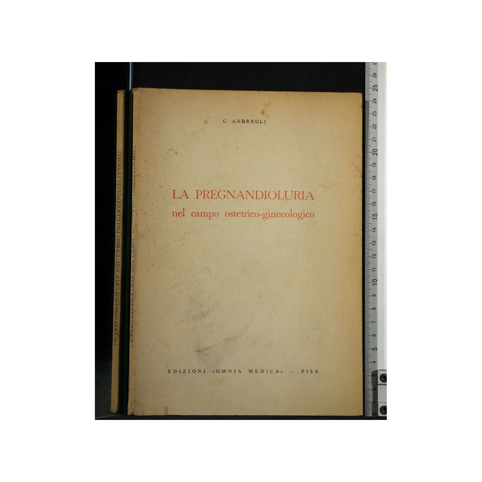 LA PREGNANDIOLURIA NEL CAMPO OSTETRICO-GINECOLOGICO