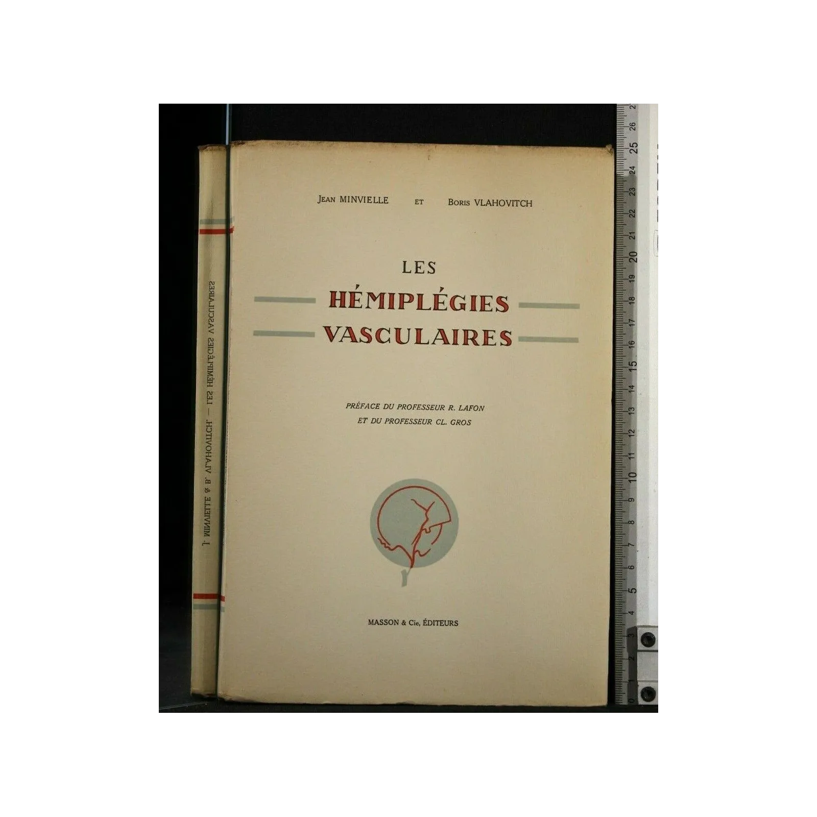 LES HEMIPLEGIES VASCULAIRES