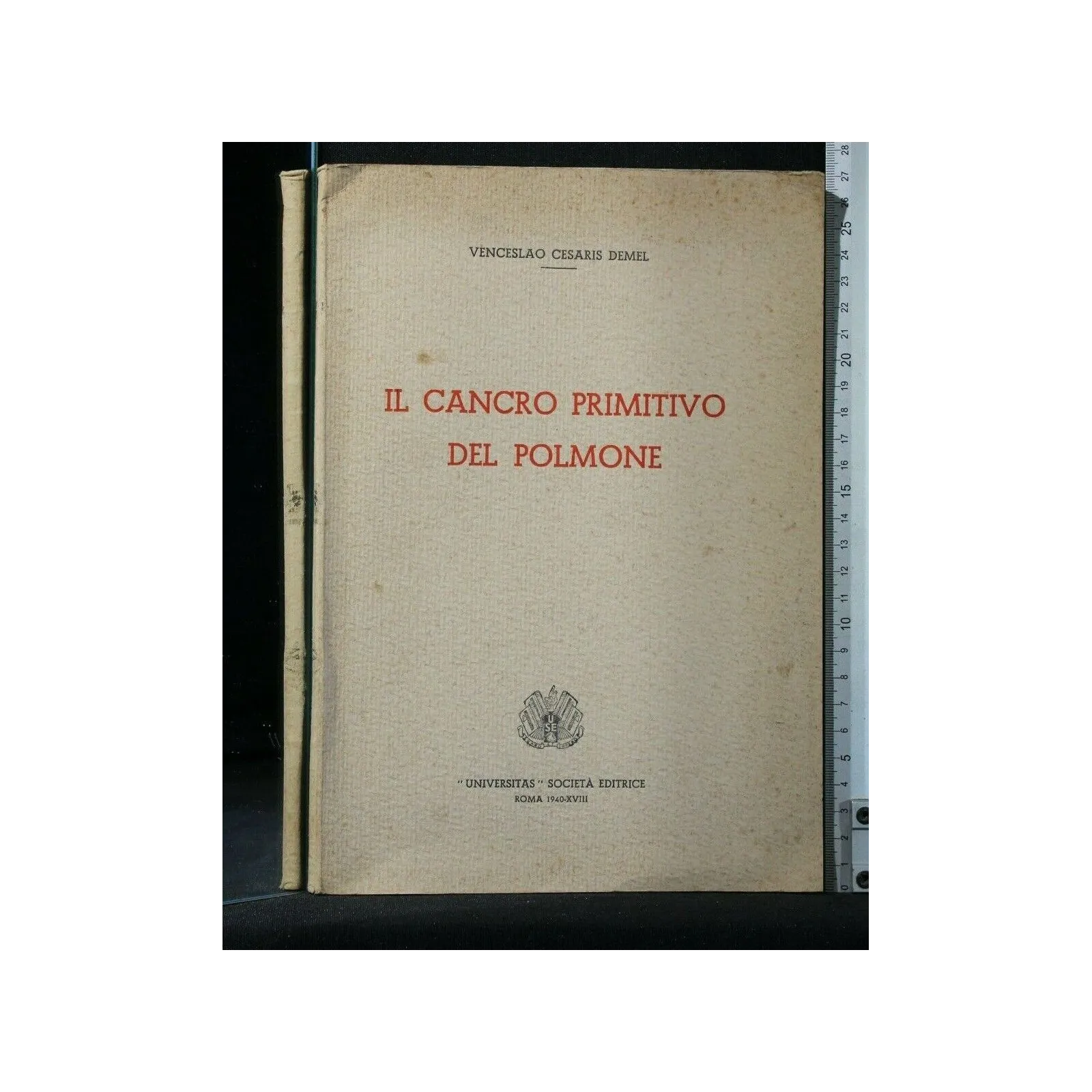 IL CANCRO PRIMITIVO DEL POLMONE