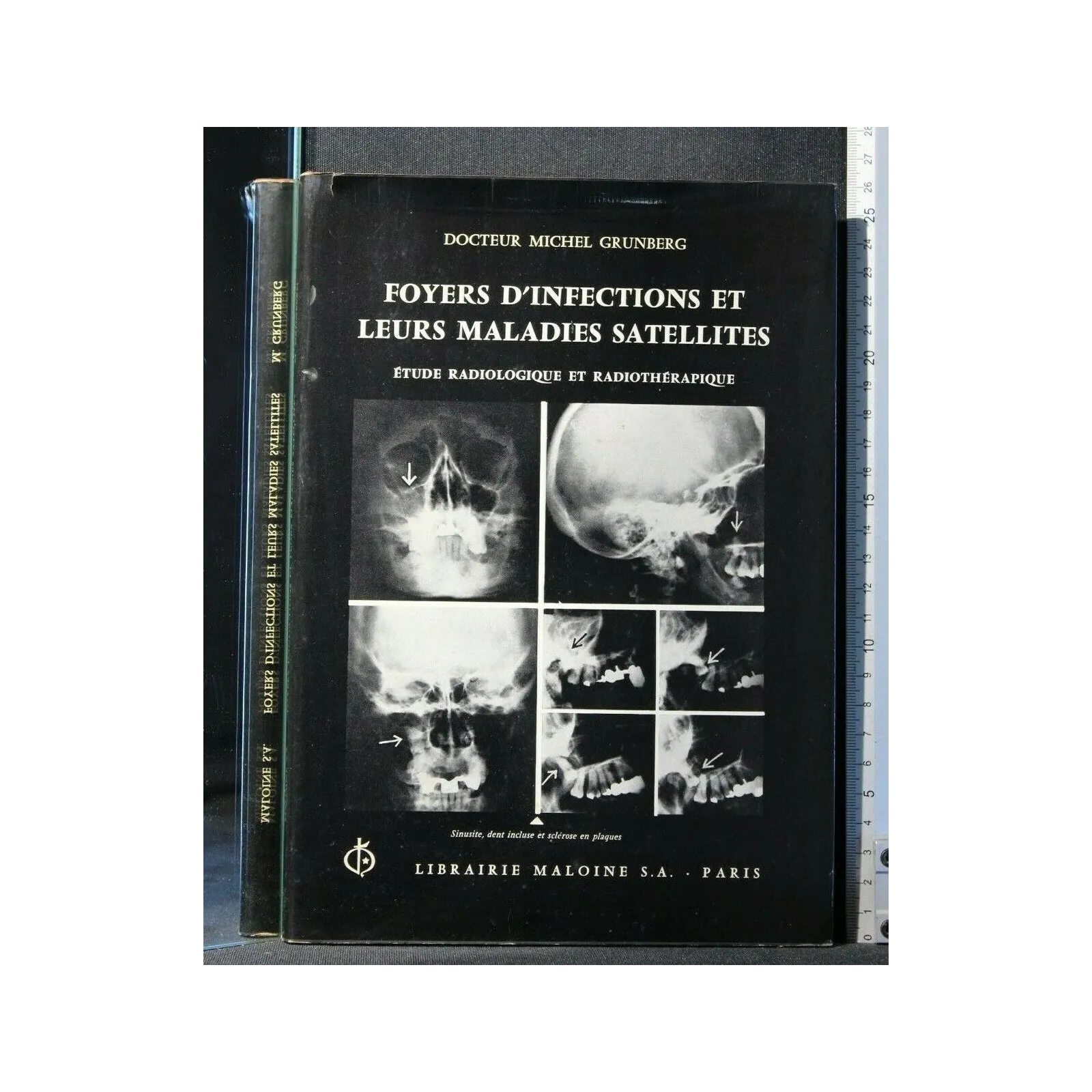 FOYERS D'INFECTIONS ET LEURS MALADIES SATELLITES ETUDE