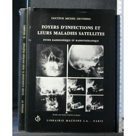 FOYERS D'INFECTIONS ET LEURS MALADIES SATELLITES ETUDE