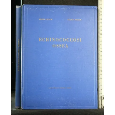 ECHINOCOCCOSI OSSEA