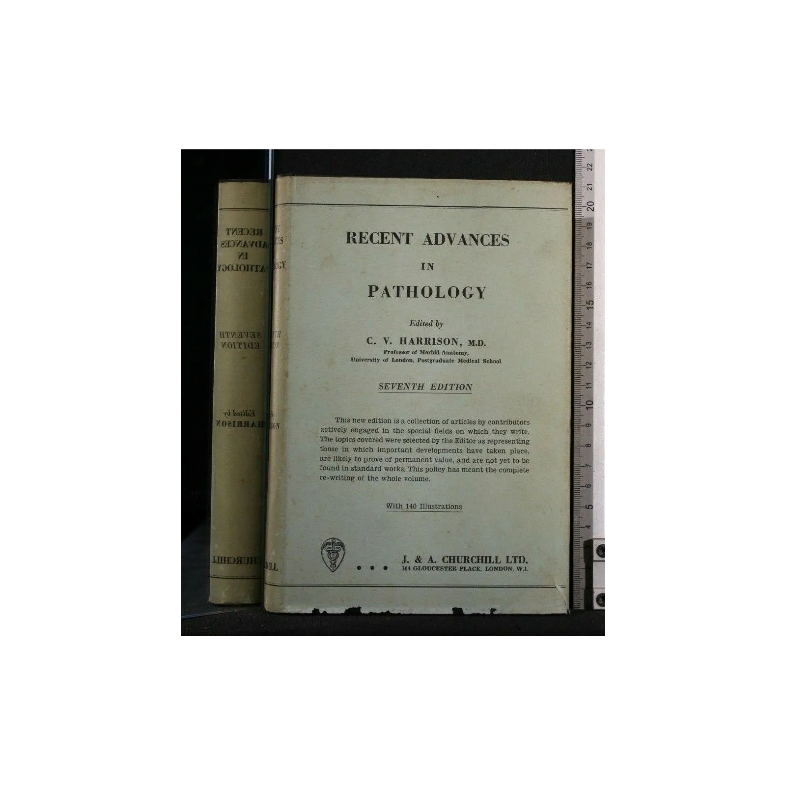 RECENT ADVANCES IN PATHOLOGY