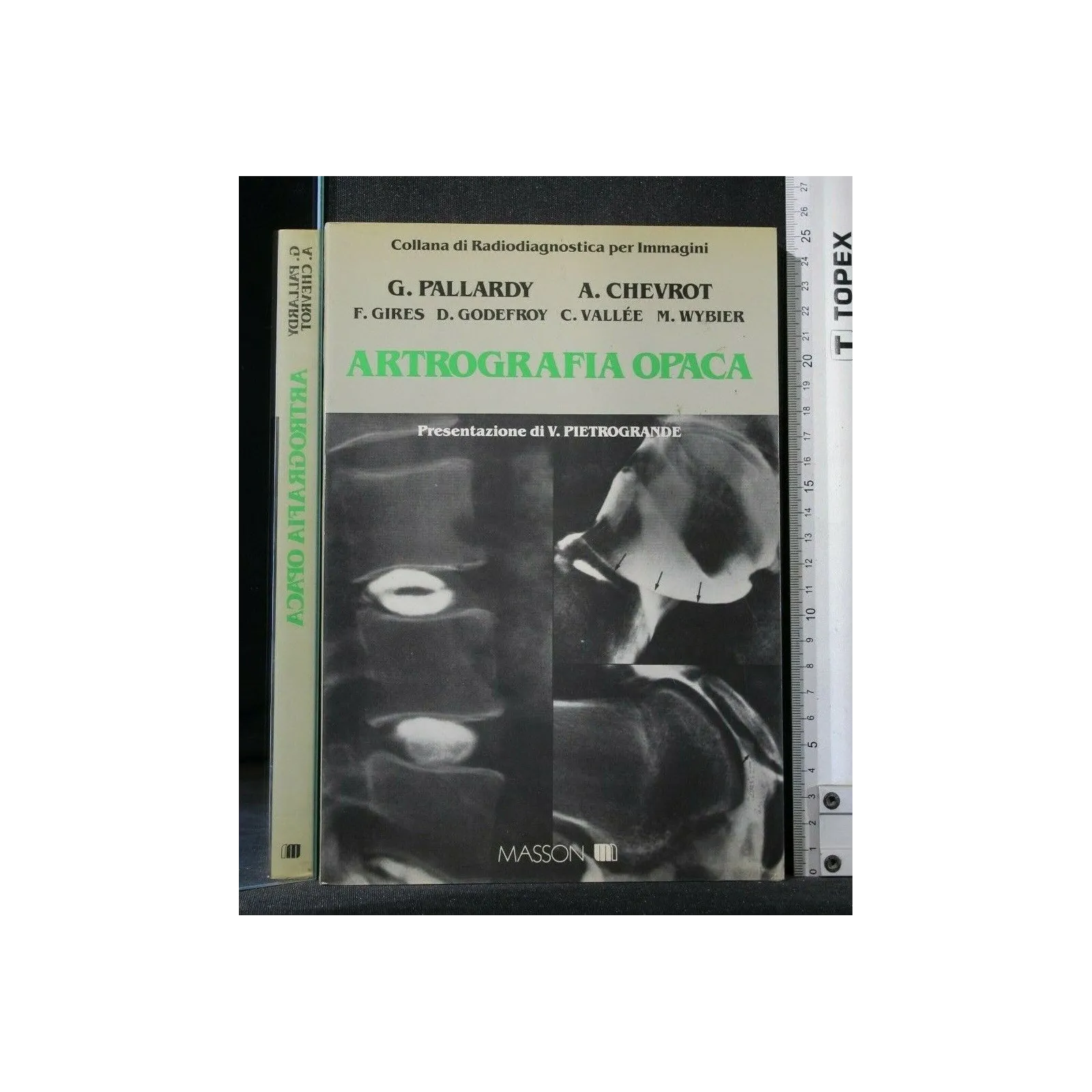 ARTROGRAFIA OPACA