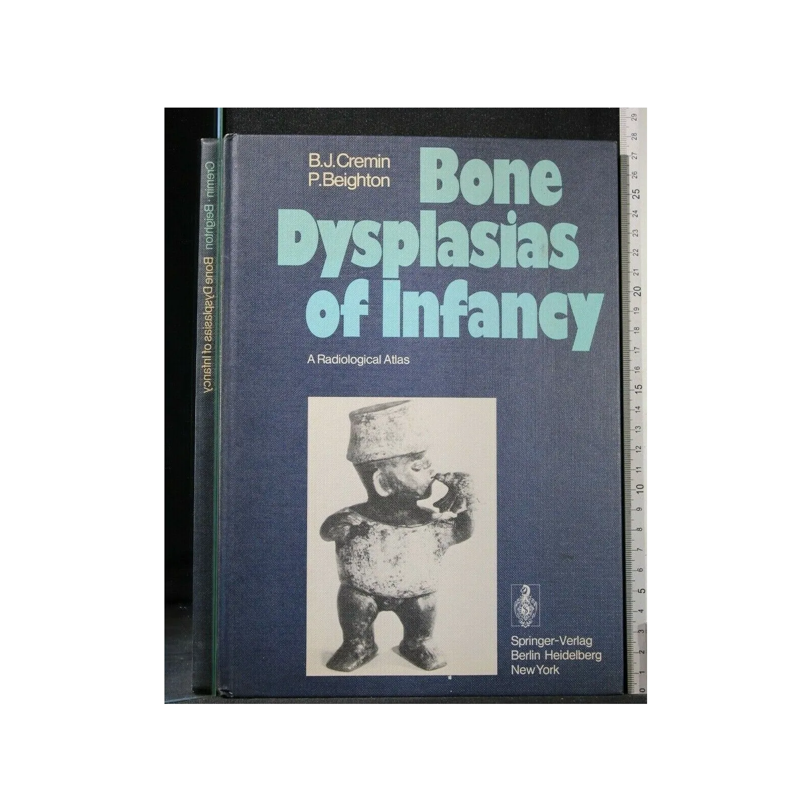 BONE DYSPLASIAS OF INFANCY