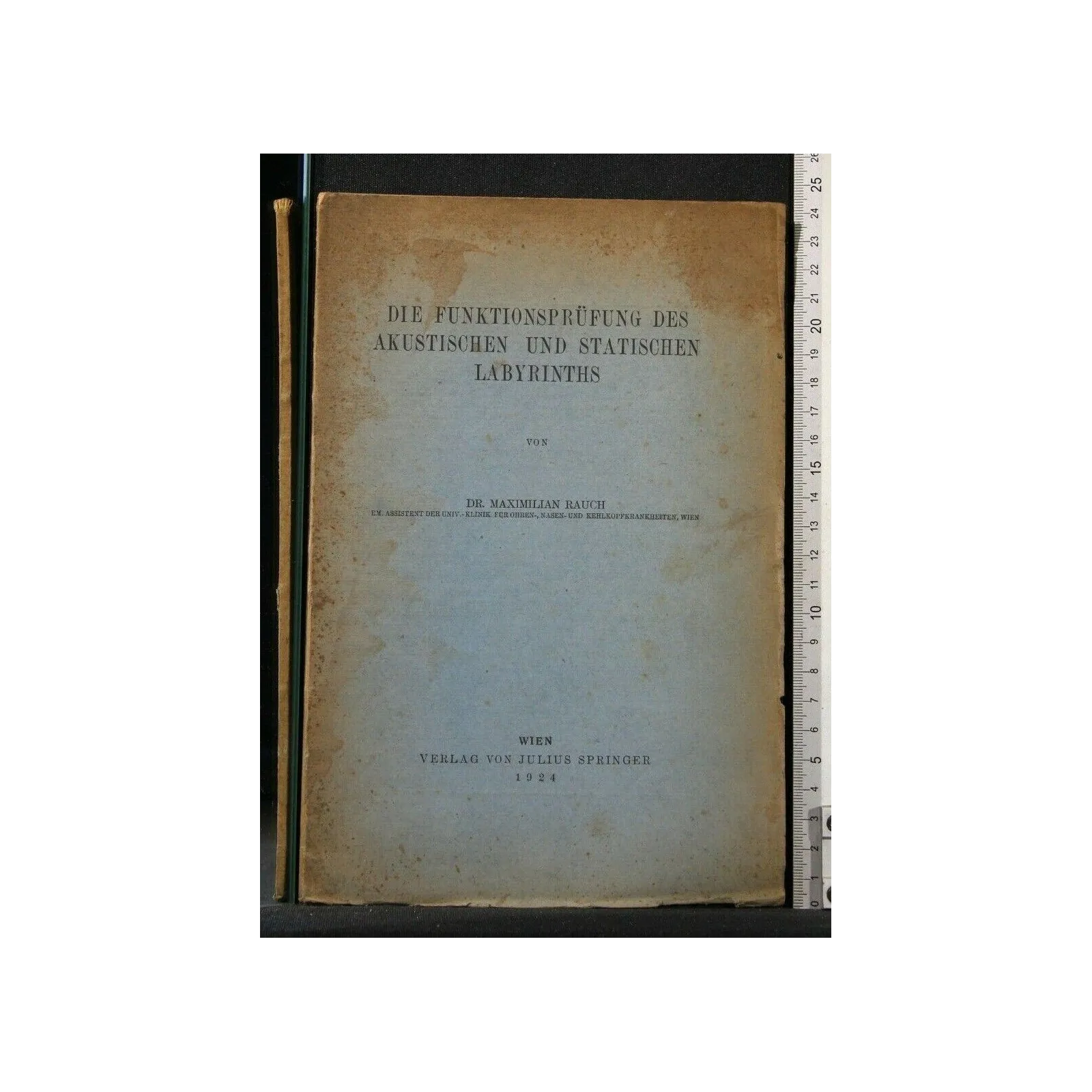 DIE FUNKTIONSPRUFUNG DES AKUSTISCHEN UND STATISCHEN LABYRINTHS