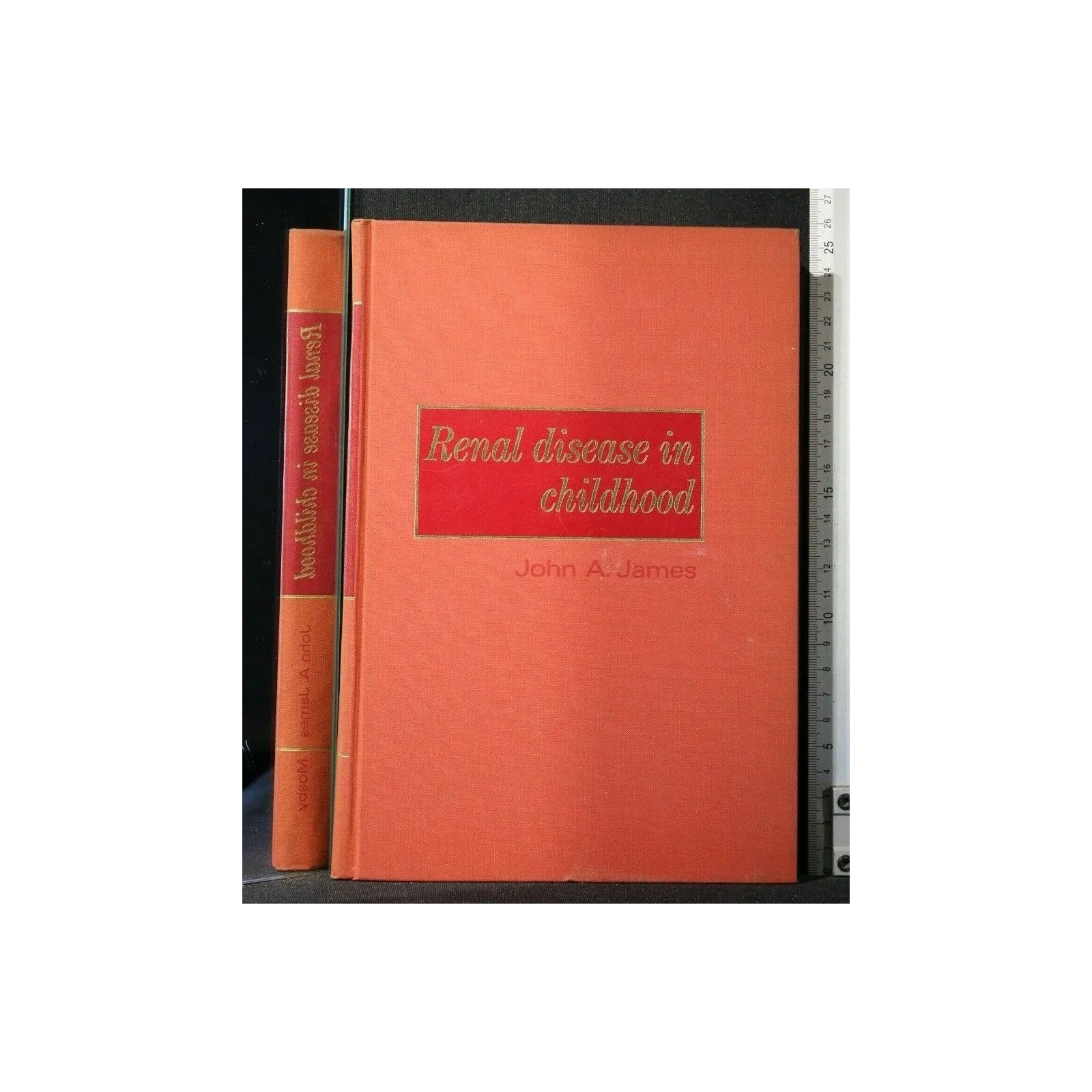 RENAL DISEASE IN CHILDHOOD