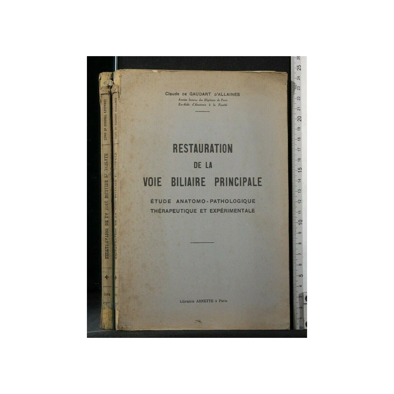 RESTAURATION DE LA VOIE BILIARE PRINCIPALE