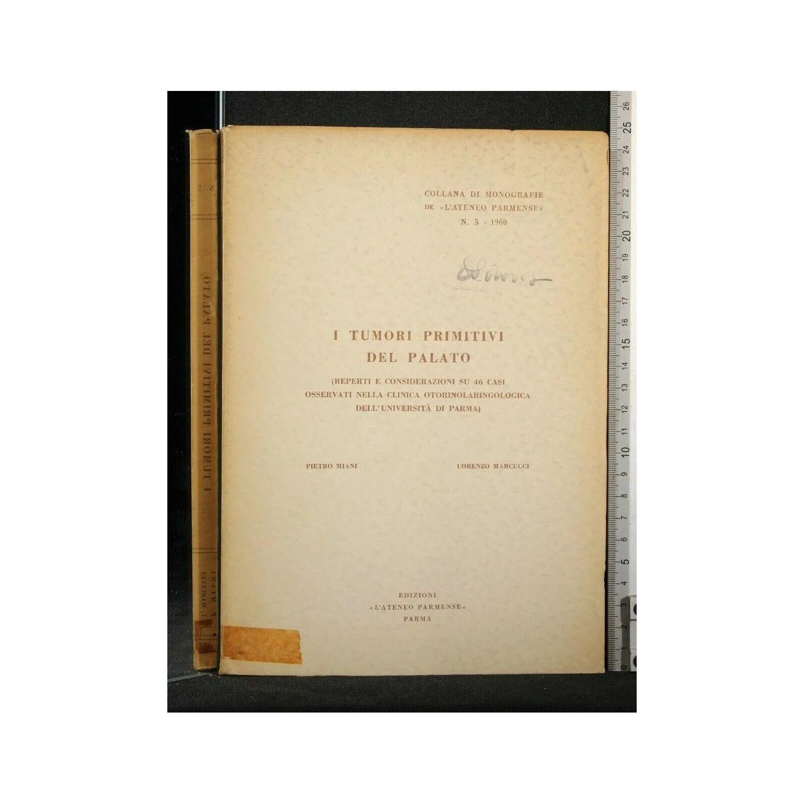 I TUMORI PRIMITIVI DEL PALATO