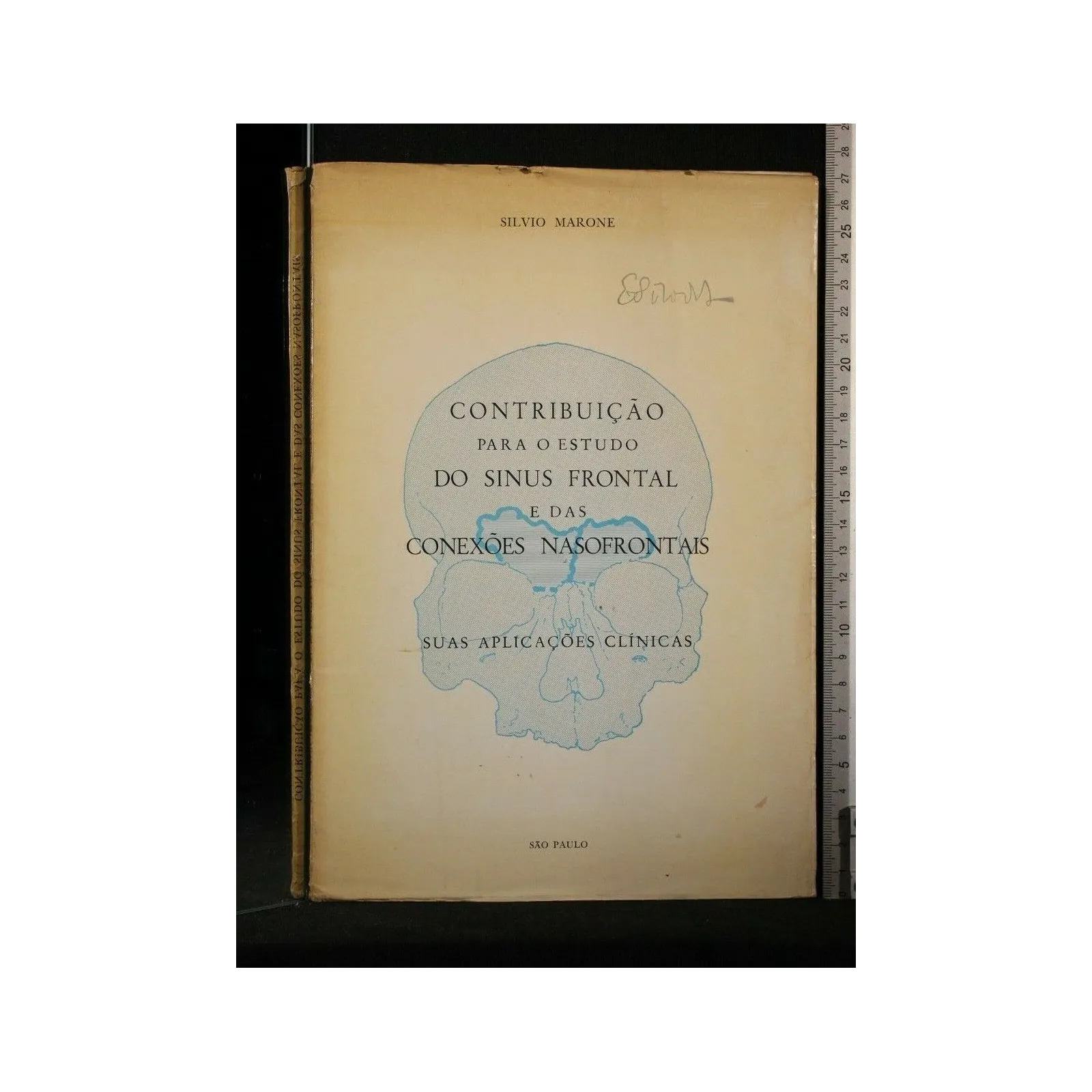 CONTRIBUICAO PARA O ESTUDO DO SINUS FRONTAL E DAS CONEXOES