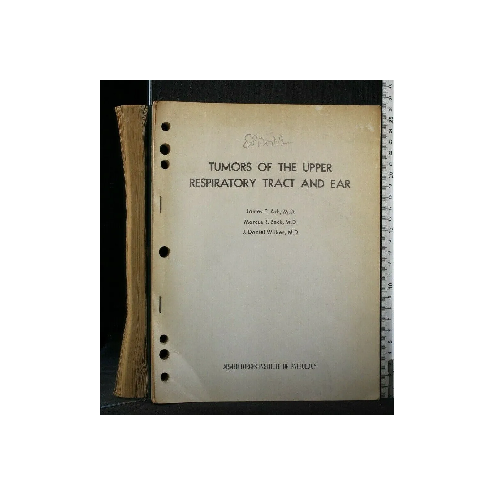 TUMORS OF THE UPPER RESPIRATORY TRACT AND EAR