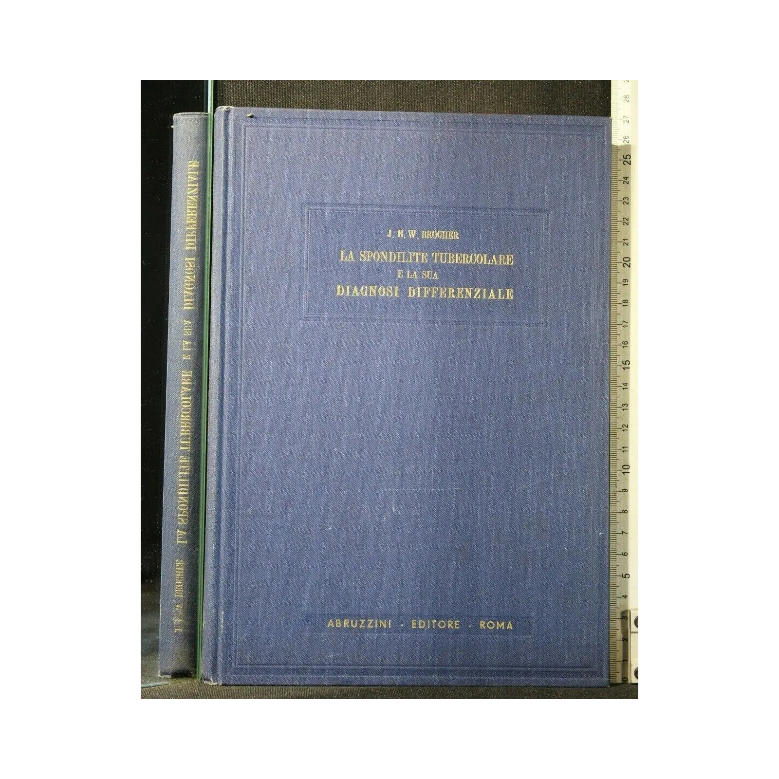 LA SPONDILITE TUBERCOLARE E LA SUA DIAGNOSI DIFFERENZIALE
