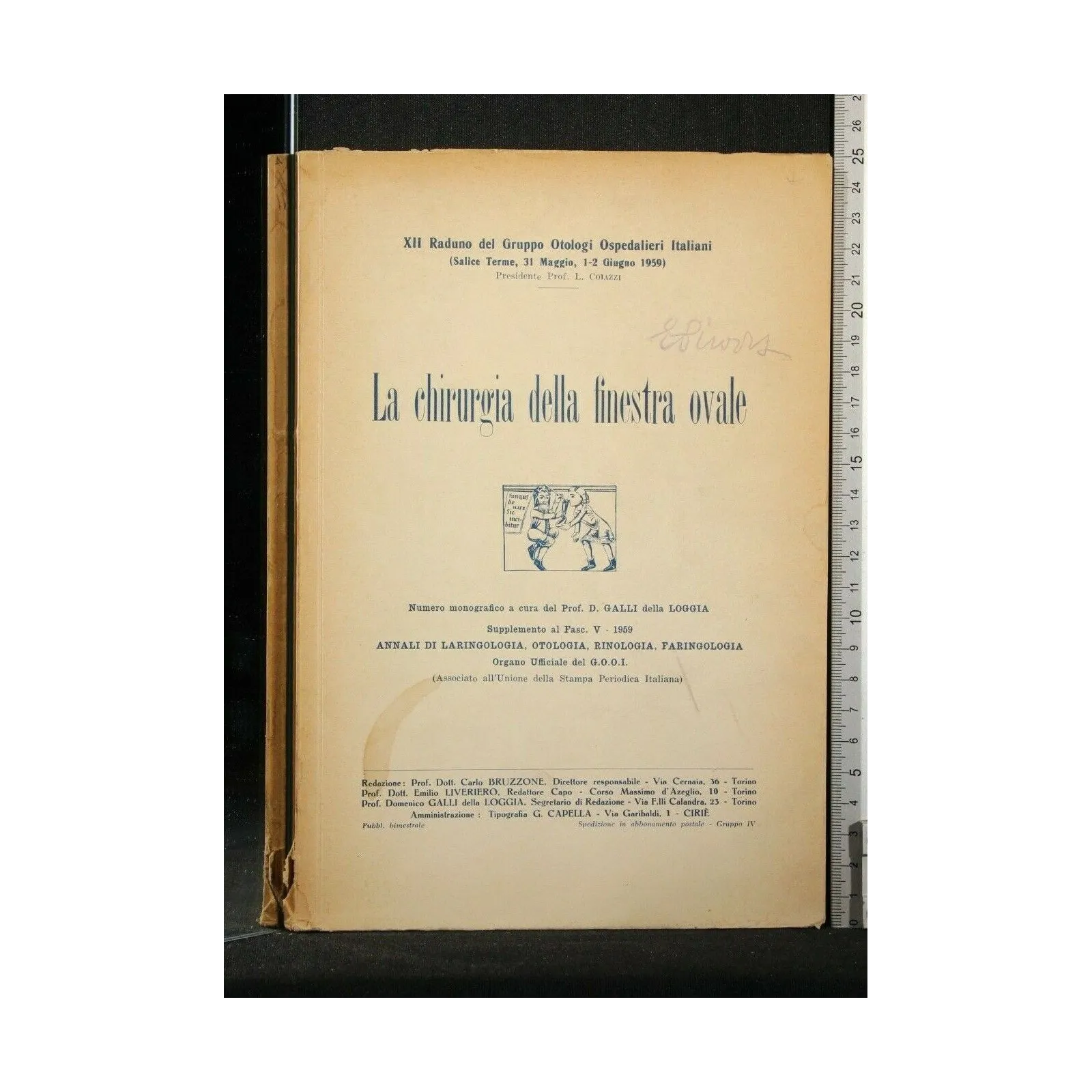 LA CHIRURGIA DELLA FINESTRA OVALE