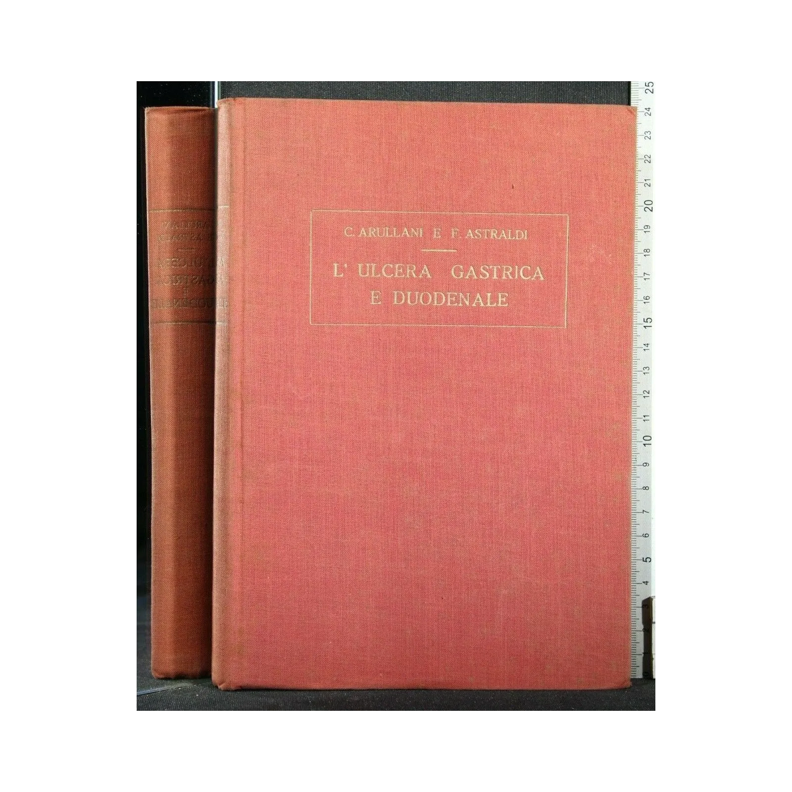 L'ULCERA GASTRICA E DUODENALE