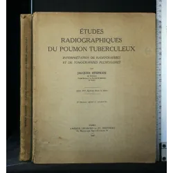 ETUDES RADIOGRAPHIQUES DU POUMON TUBERCULEUX