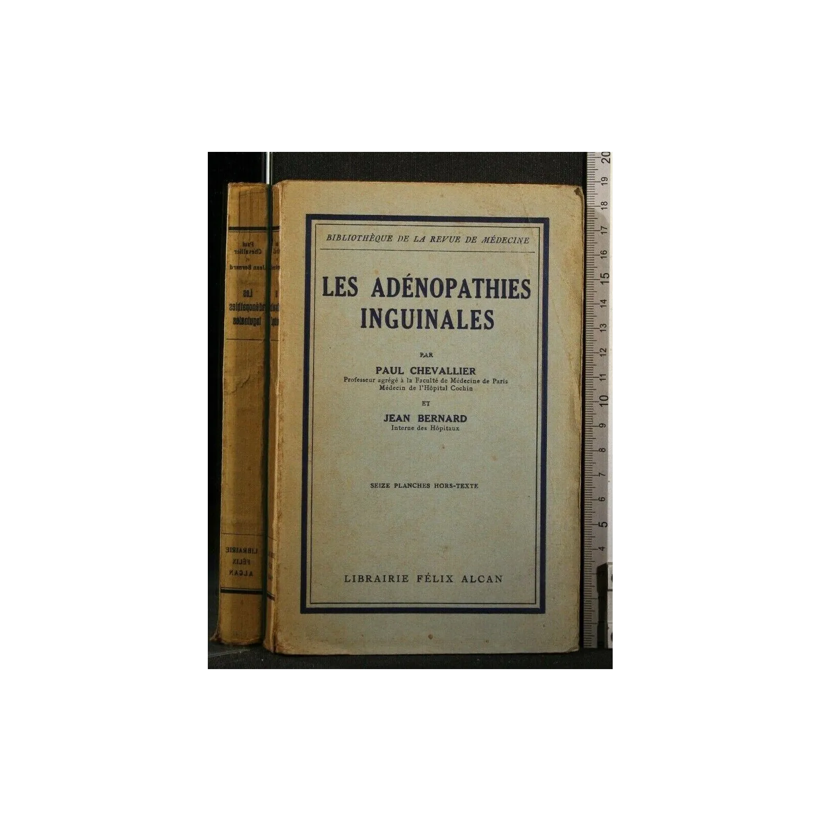 LES ADENOPATHIES INGUINALES