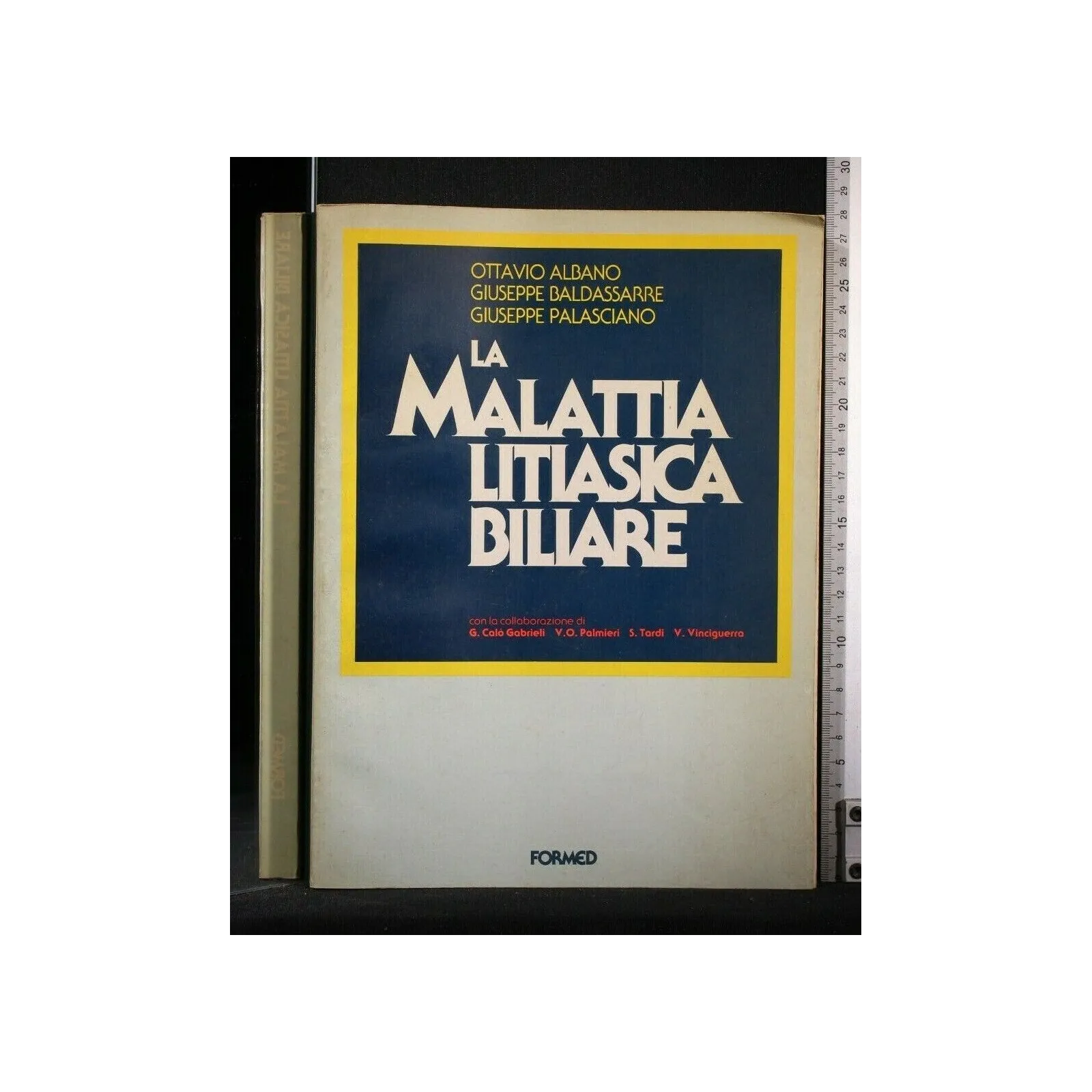 LA MALATTIA LITIASICA BILIARE