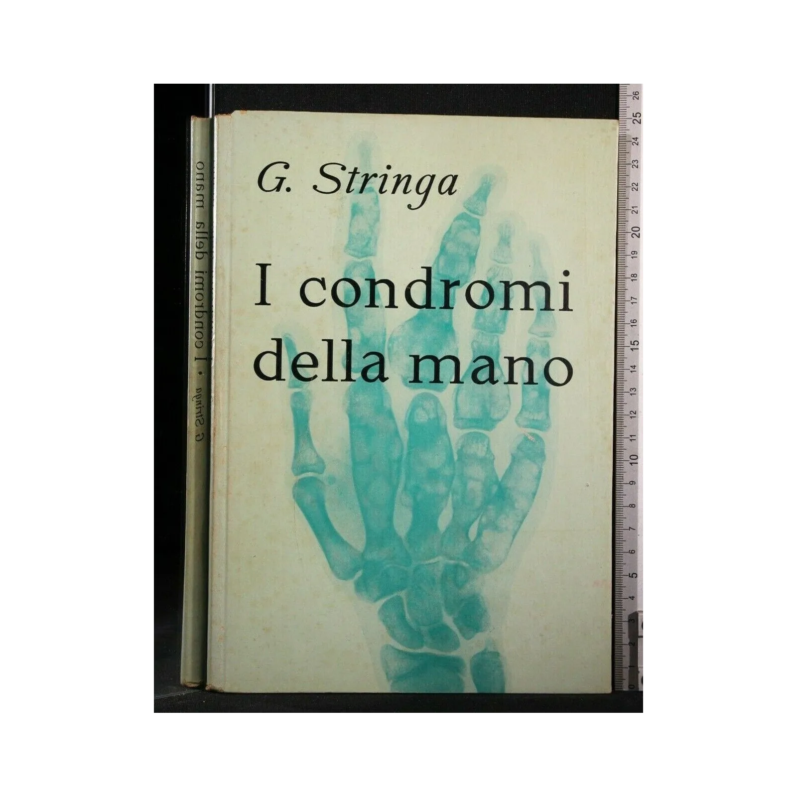 I CONDROMI DELLA MANO