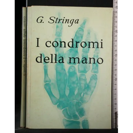 I CONDROMI DELLA MANO