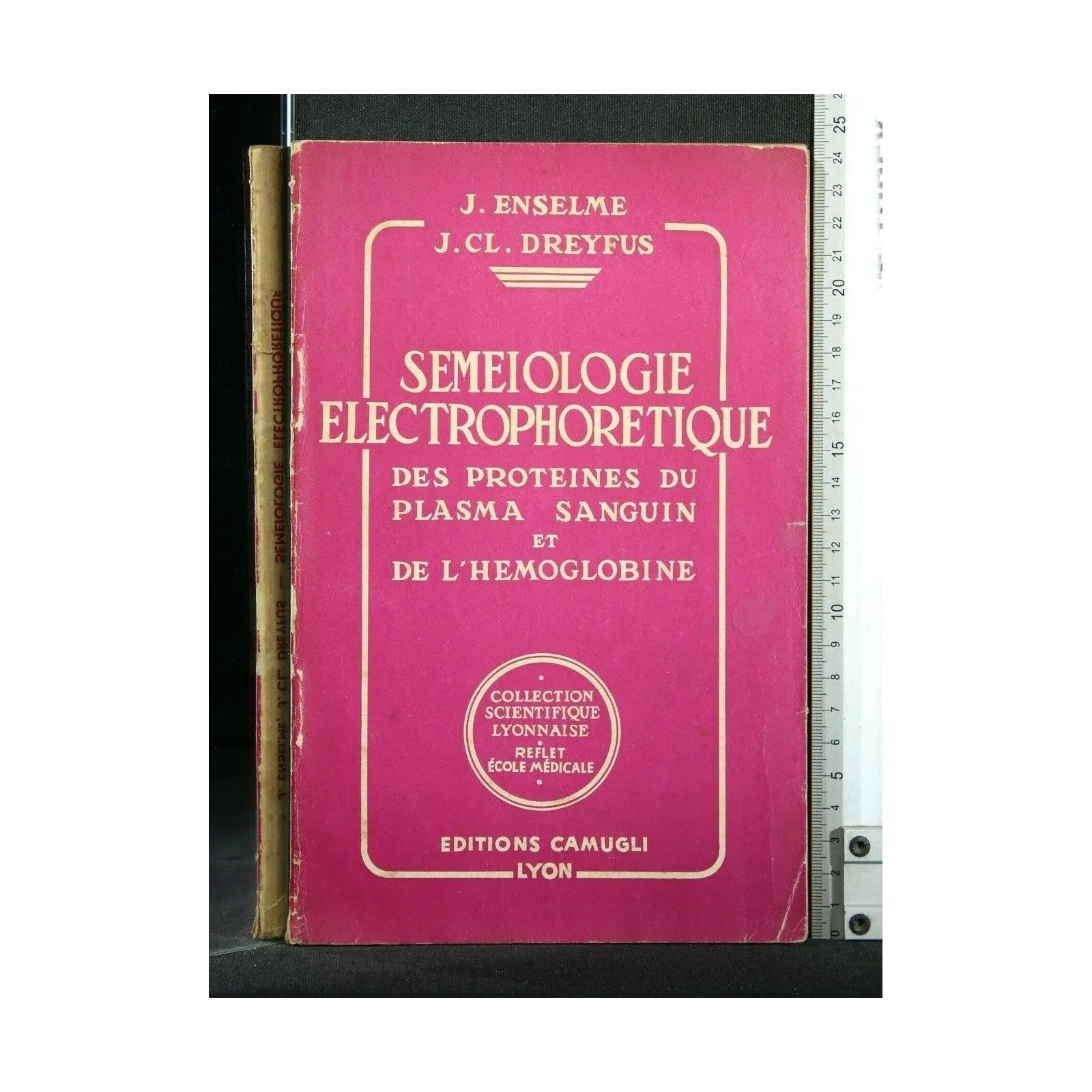 SEMEIOLOGIE ELECTROPHORETIQUE DES PROTEINES DU PLASMA SANGUIN DE