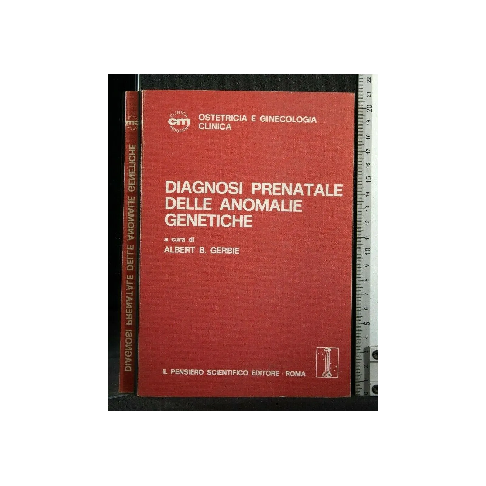 DIAGNOSI PRENATALE DELLE ANOMALIE GENETICHE