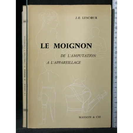 LE MOIGNON DE L'AMPUTATION A L'APPAREILLAGE