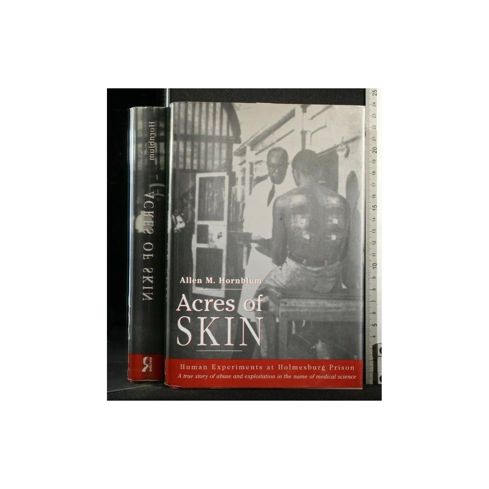 ACRES OF SKIN. ALLEN HORNBLUM. ROUTLEDGE.