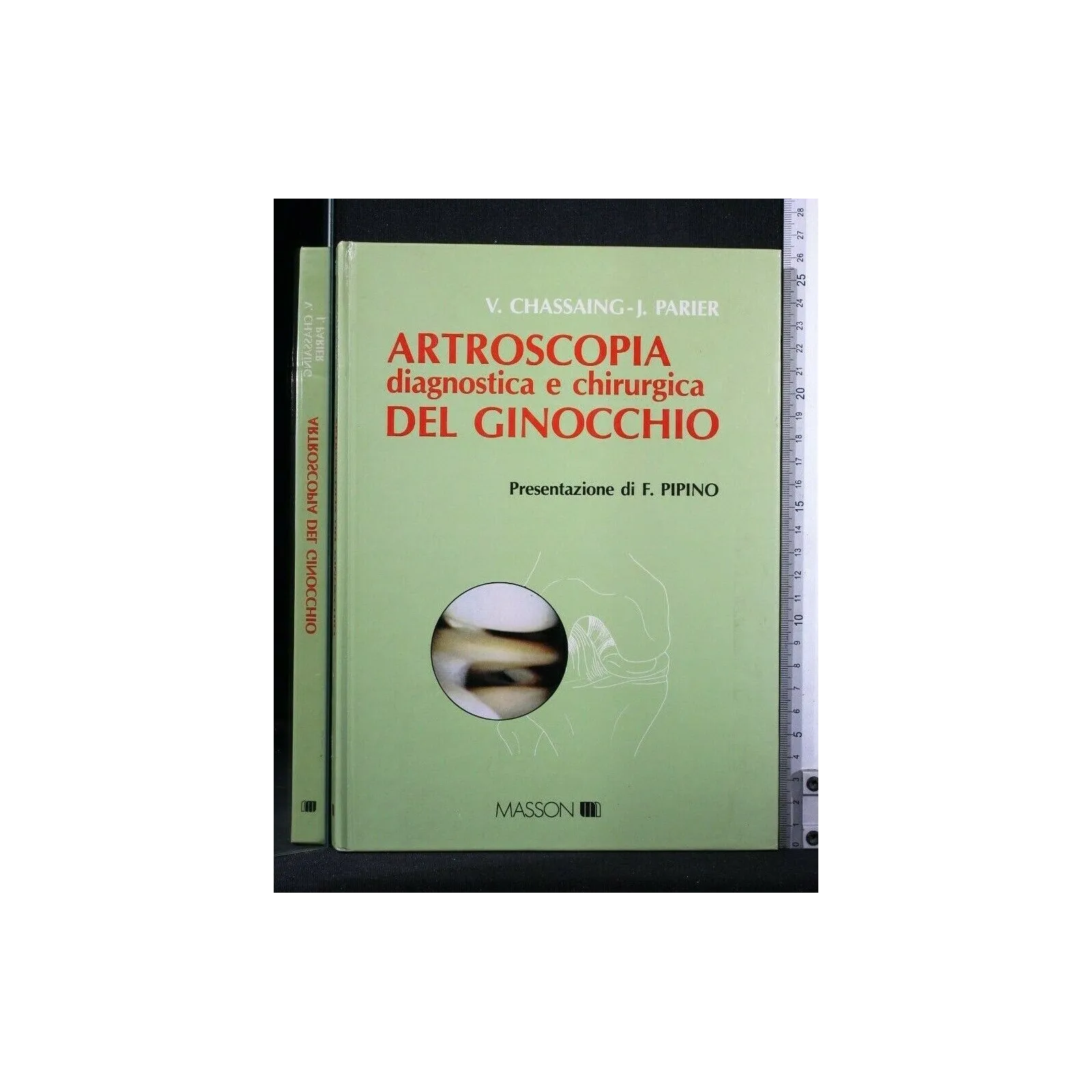ARTROSCOPIA DIAGNOSTICA E CHIRURGICA DEL GINOCCHIO