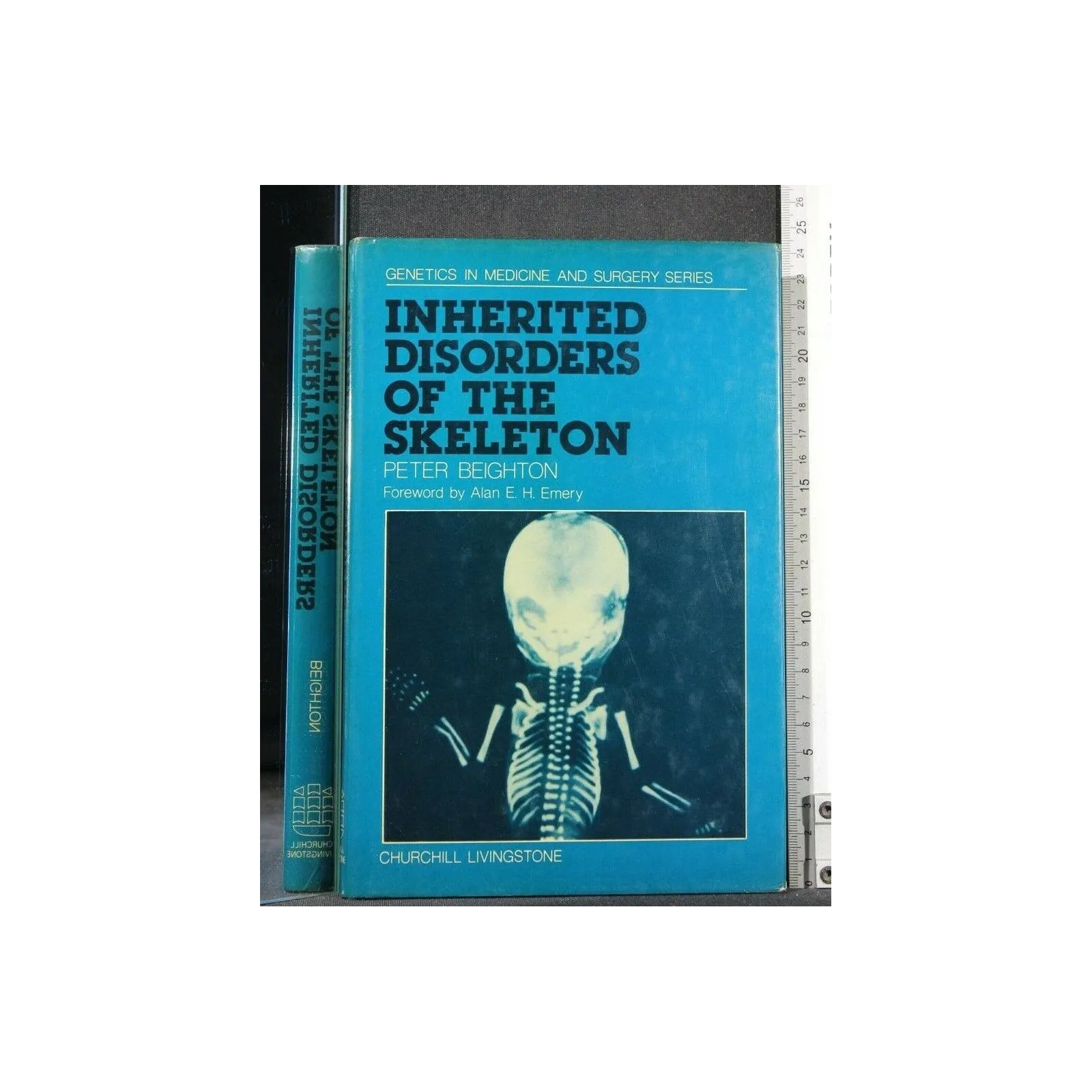 INHERITED DISORDERS OF THE SKELETON