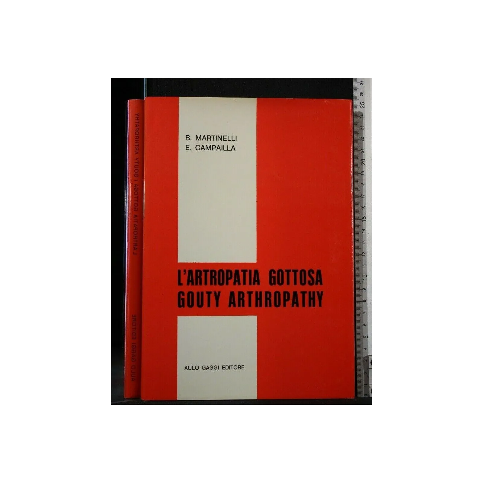 L'ARTROPATIA GOTTOSA