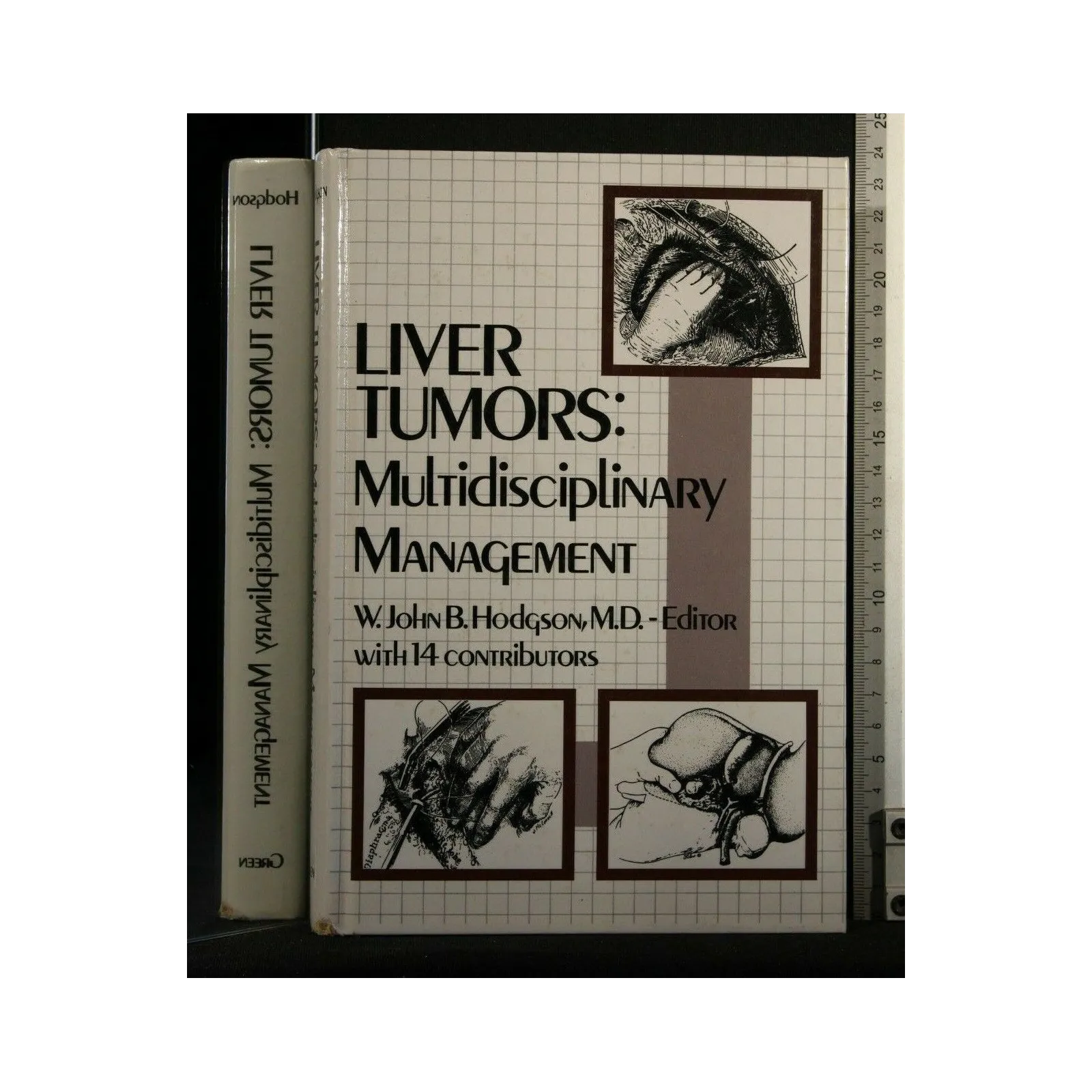 LIVER TUMORS: MULTIDISCIPLINARY MANAGEMENT