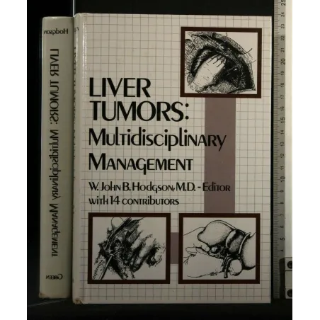 LIVER TUMORS: MULTIDISCIPLINARY MANAGEMENT