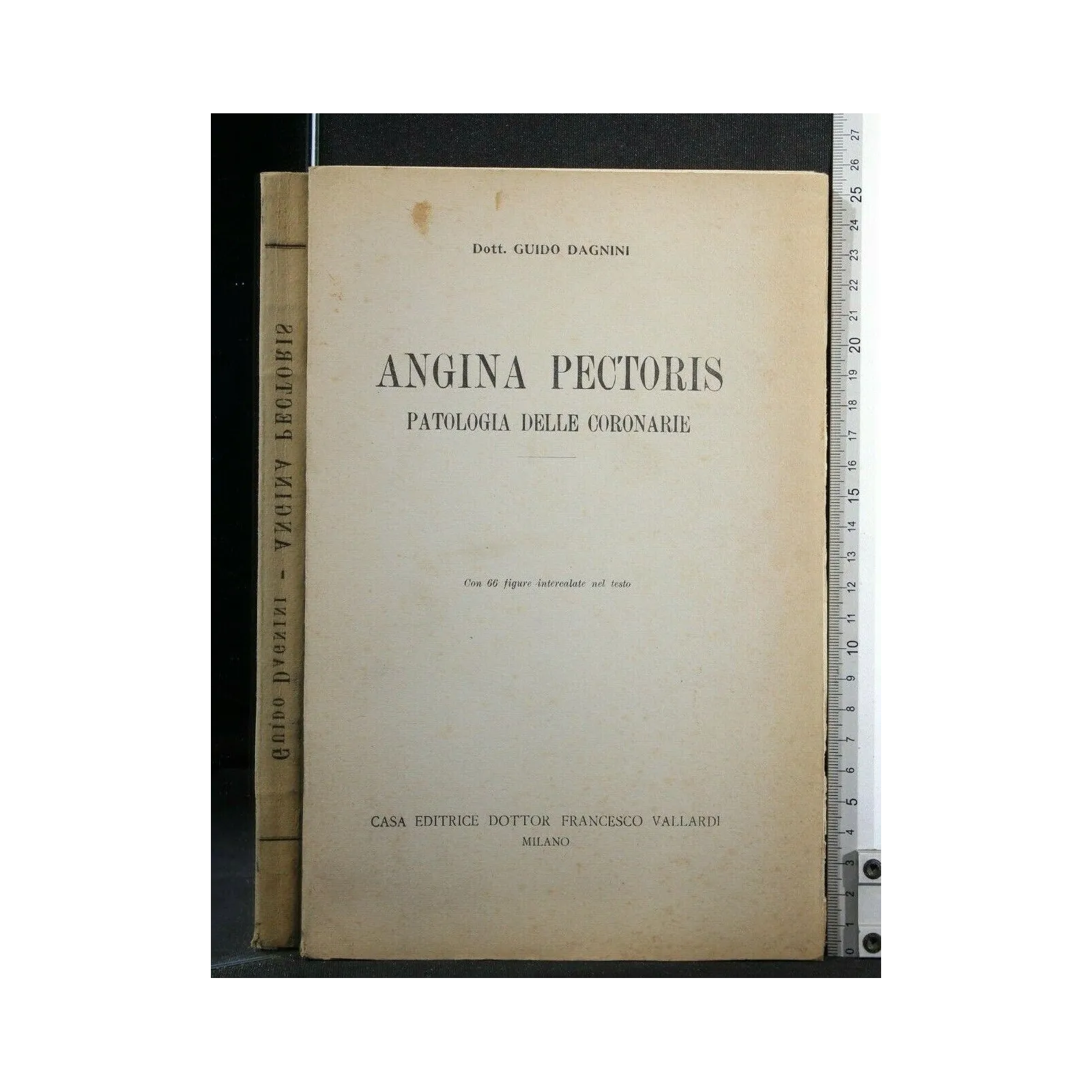 ANGINA PECTORIS PATOLOGIA DELLE CORONARIE