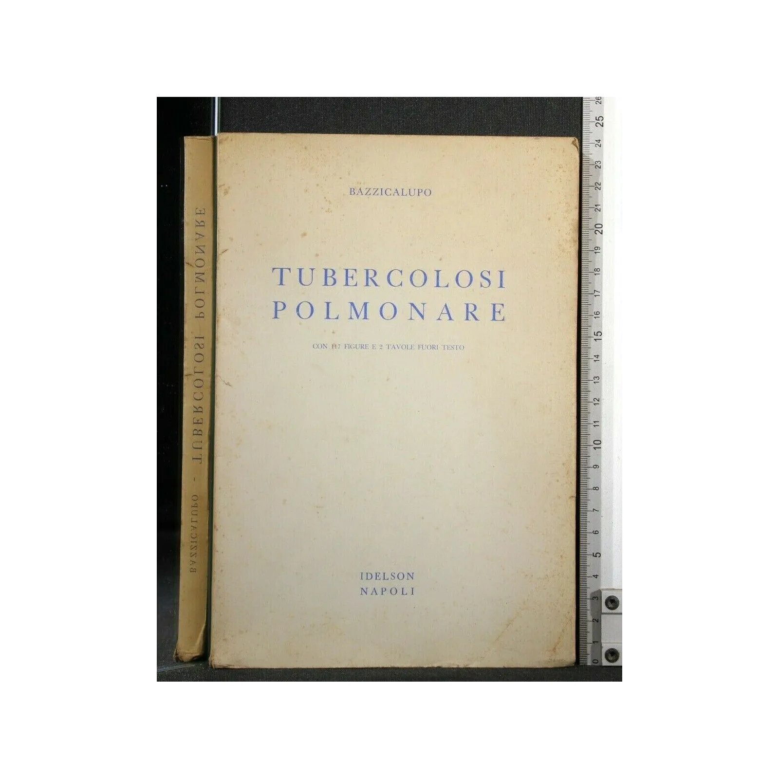 TUBERCOLOSI POLMONARE