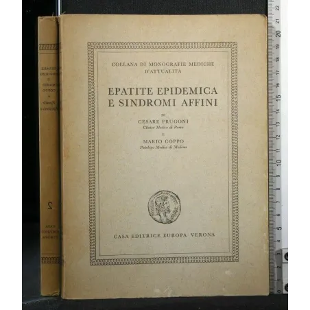 EPATITE EPIDEMICA E SINDROMI AFFINI