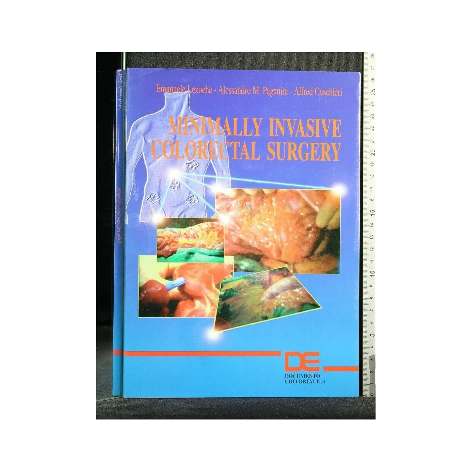 MINIMALLY INVASIVE COLORECTAL SURGERY