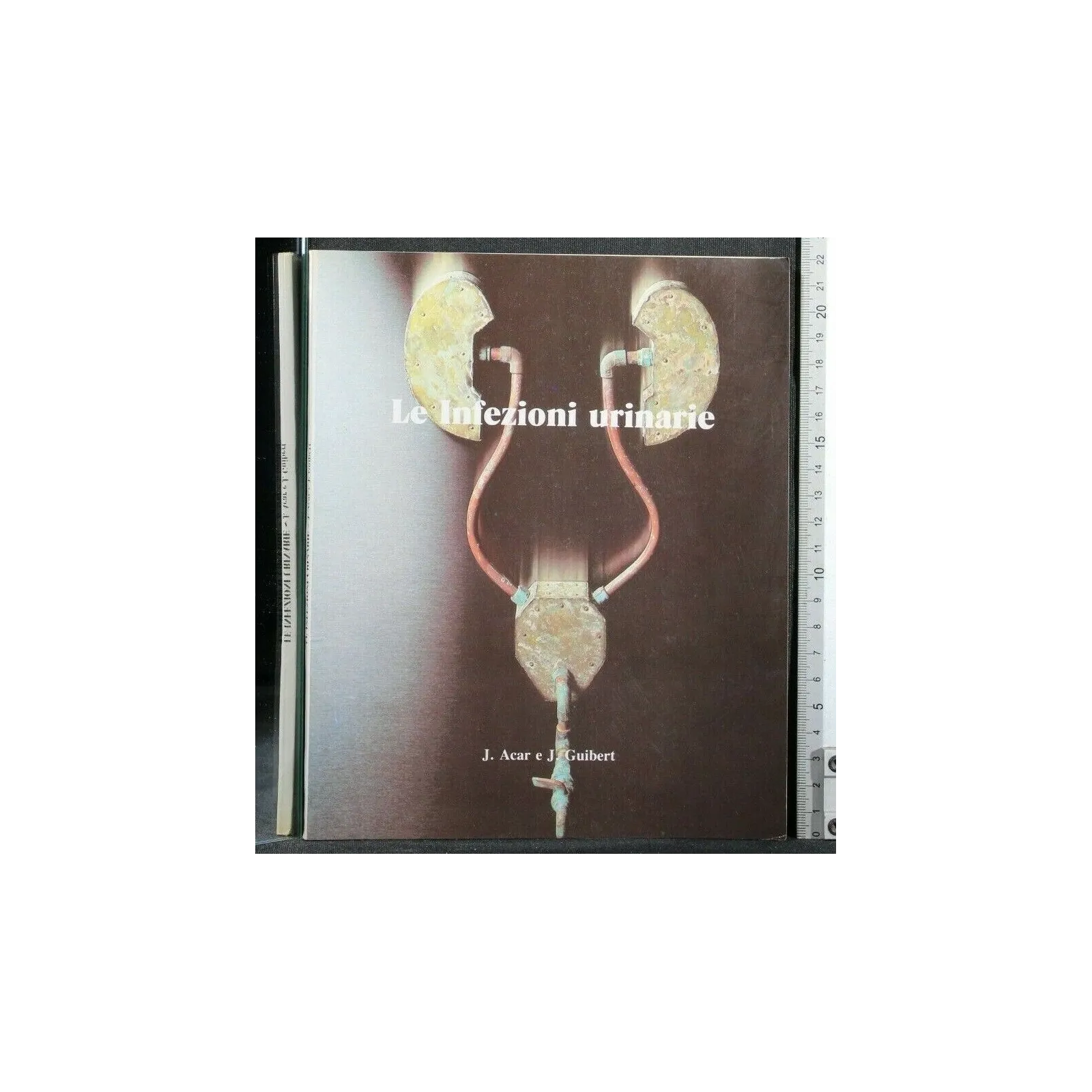 LE INFEZIONI URINARIE