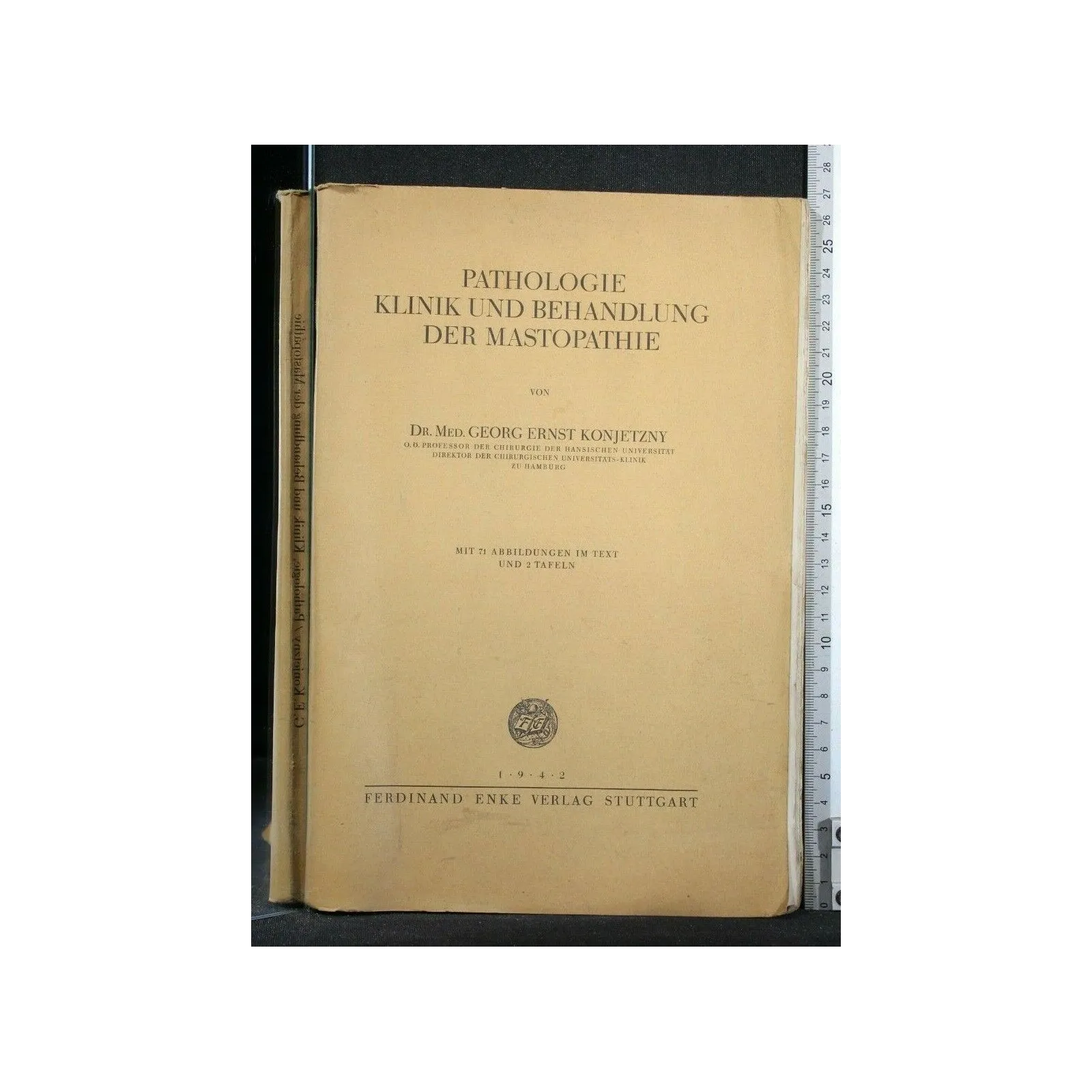 PATHOLOGIE KLINIK UND BEHANDLUNG DER MASTOPATHIE