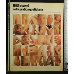 GLI ECZEMI NELLA PRATICA QUOTIDIANA